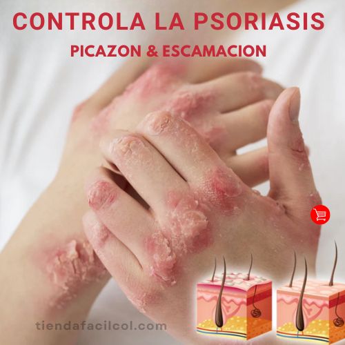 Kolmax 2x1 Spray Psoriasis