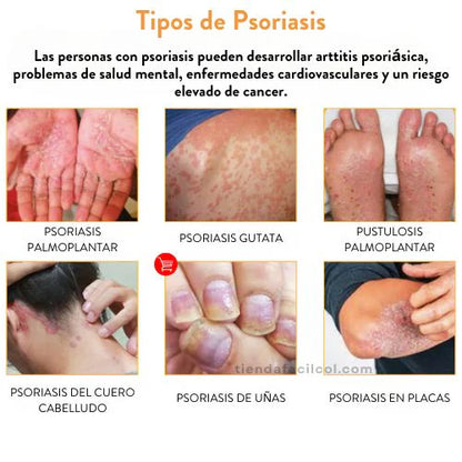 Kolmax 2x1 Spray Psoriasis
