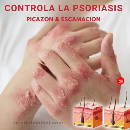 Kolmax 2x1 Spray Psoriasis